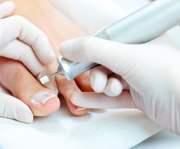 Chiropodist seeing to someones feet